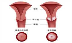广州试管代怀代怀价钱，广州试管代怀孕周期多久？