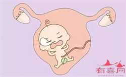 广州试管代怀不合法，广州代怀孕的概念